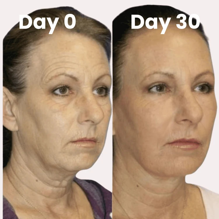 Koriderm⁺ Time Reverse Cream (All-In-One)