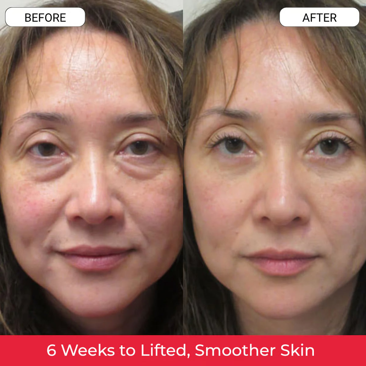 Koriderm⁺ Time Reverse Cream (All-In-One)