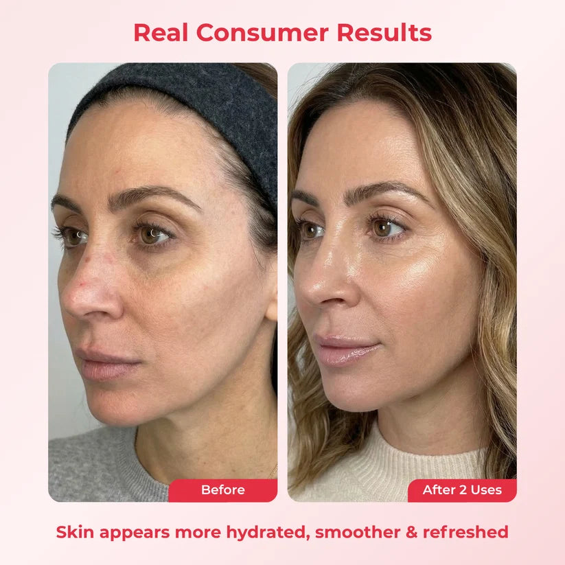 PDRN Deep Mask (4 Masks).